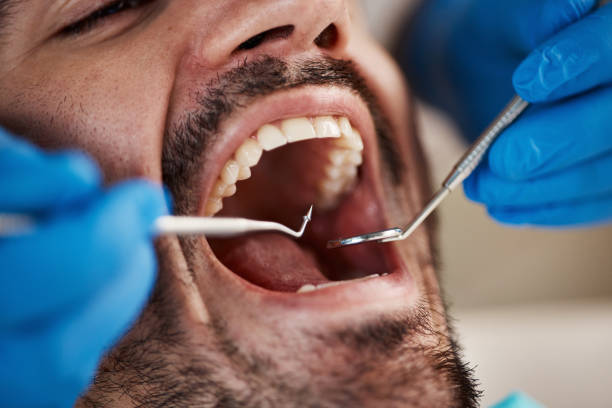Best Emergency Denture Repair in Inkster, MI